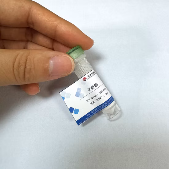 Uao Enzyme Preparation Raw Materials for in Vitro Diagnostic Kits 